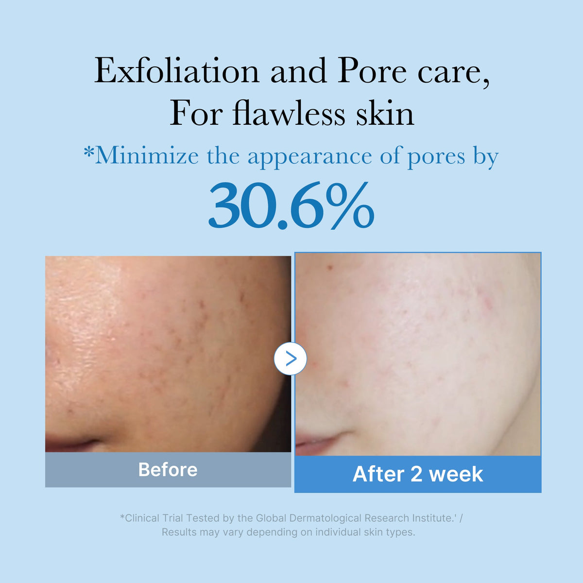 Zero Pore Toner J7