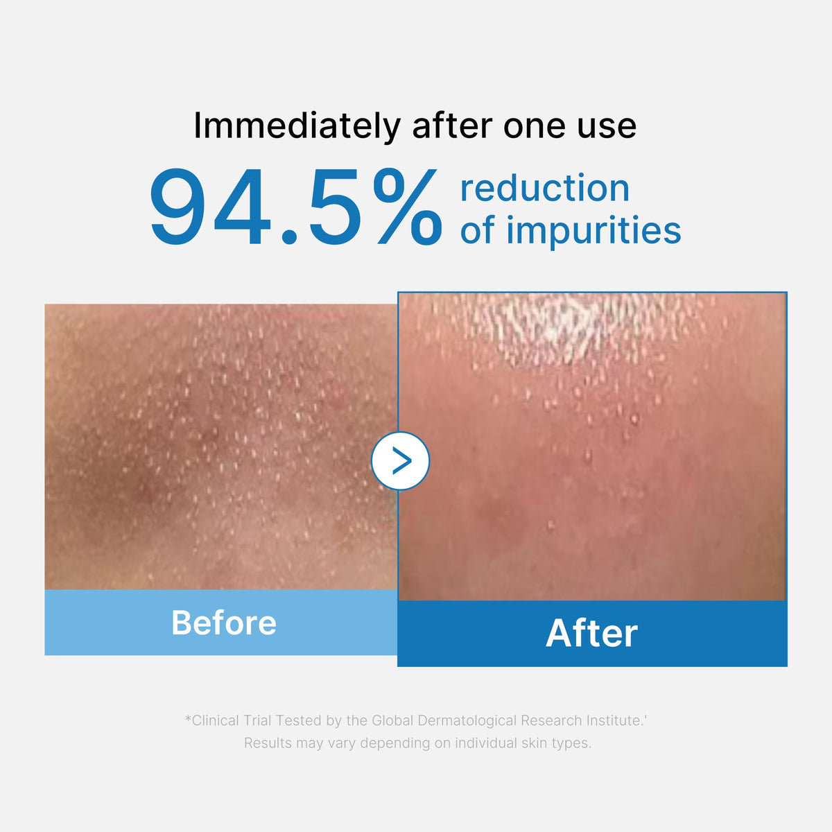Zero Pore Blackhead Deep Cleansing Oil L1