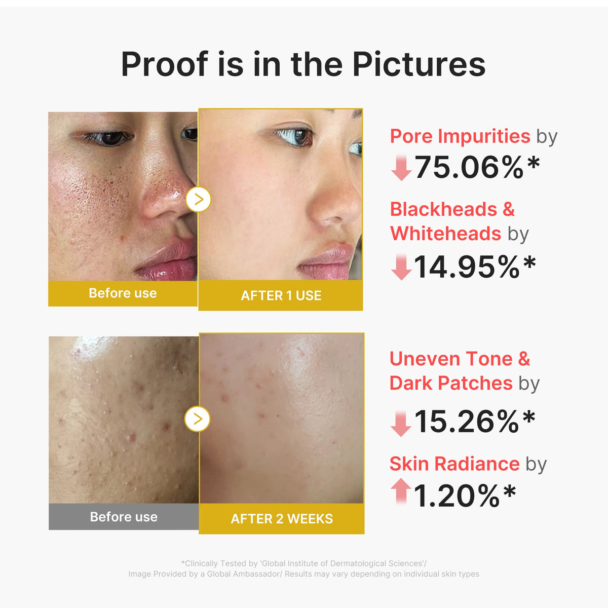 Kojic Acid Turmeric Peel Shot X1