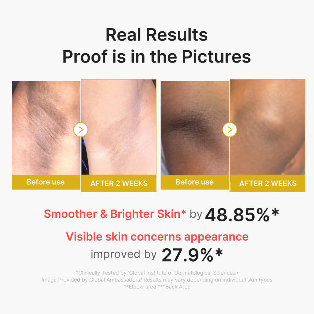 Kojic Acid Turmeric Body Peel Shot D2