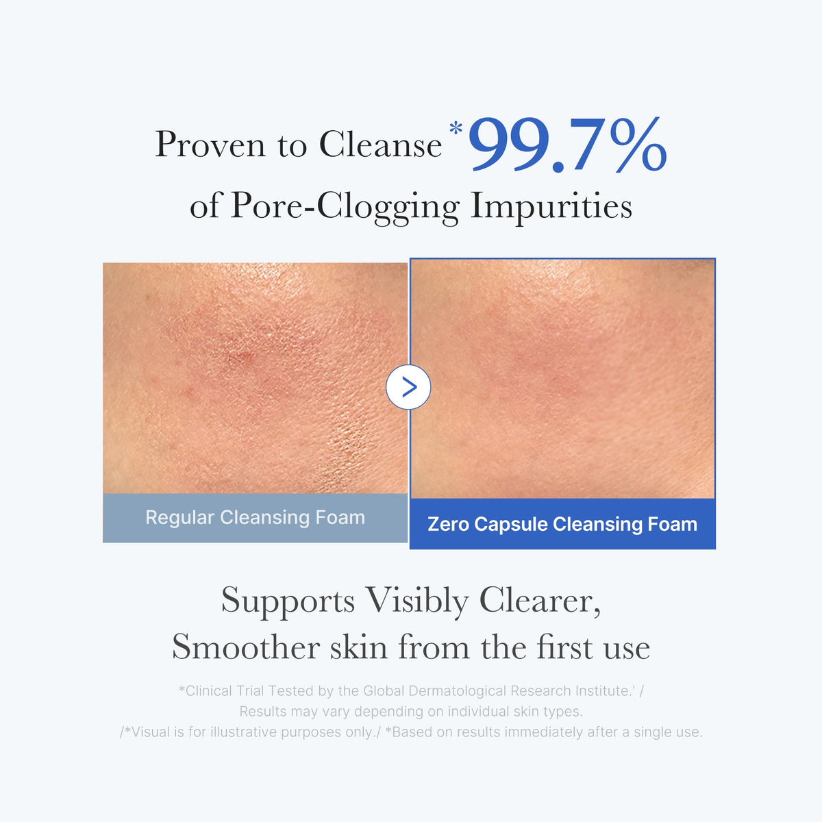 Zero Pore Capsule Cleansing Foam V5