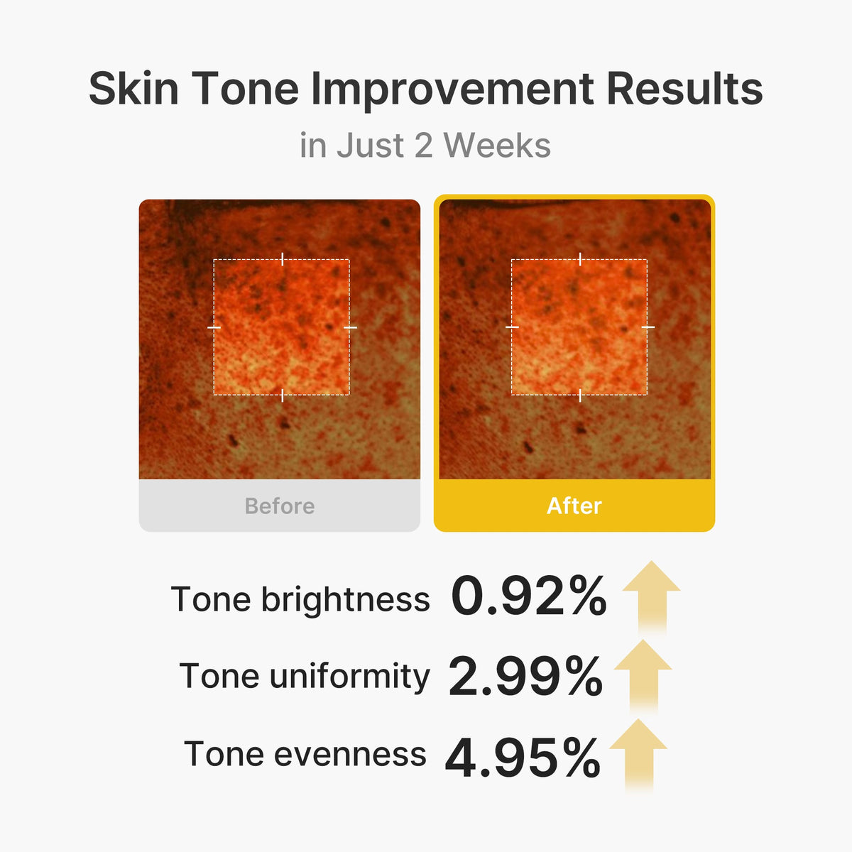 Kojic Acid Turmeric Vita Capsule Cream B5