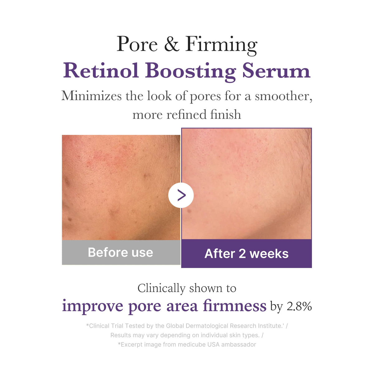 Retinol NMN Boosting Serum K6