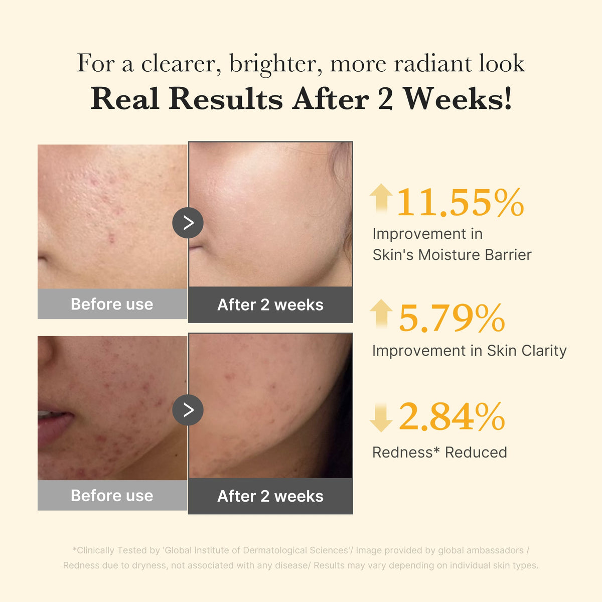 Kojic Acid Turmeric Capsule Serum S9