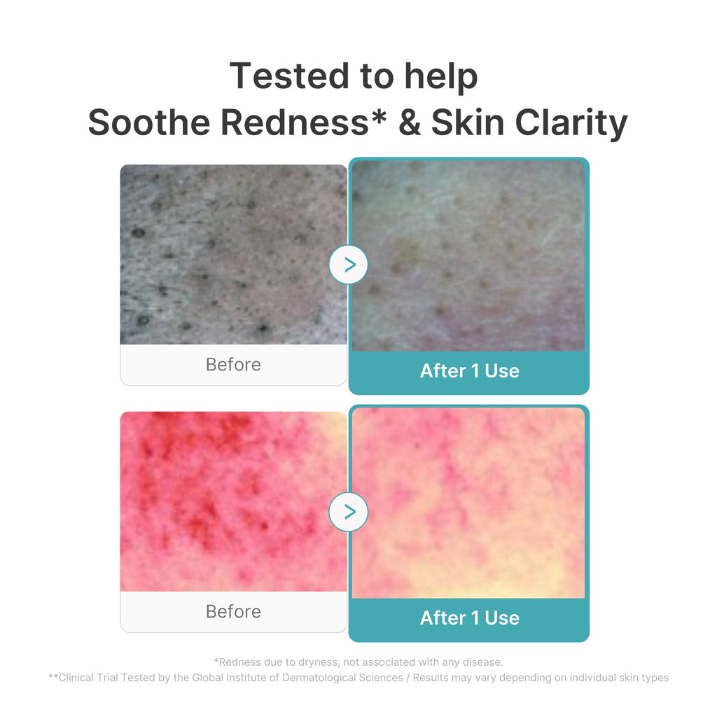 Azelaic Acid Capsule Foam Cleanser D8