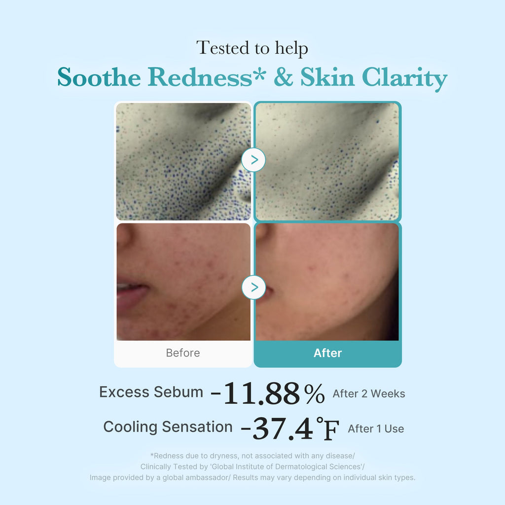 Azelaic Acid Niacinamide Clarifying Toner T4