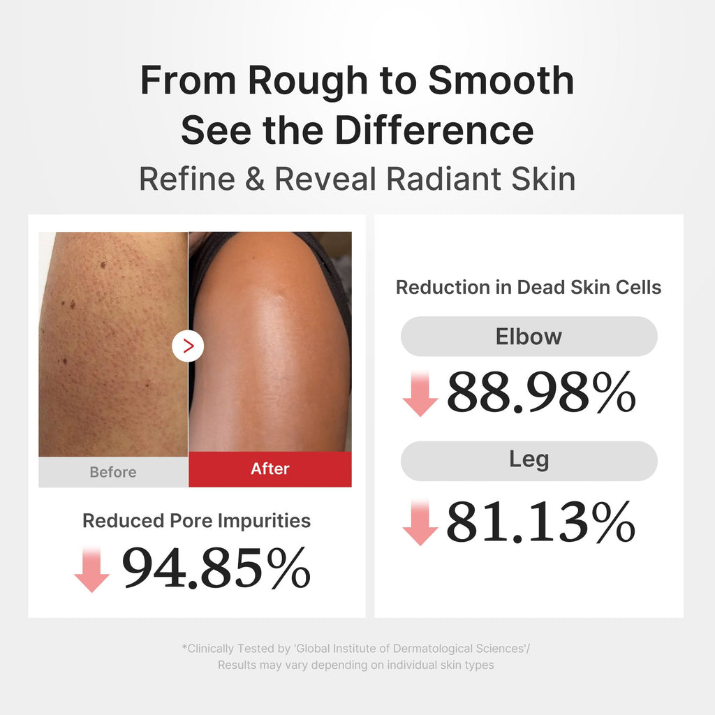 Hypochlorous Acid Rice Body Peel Shot B7