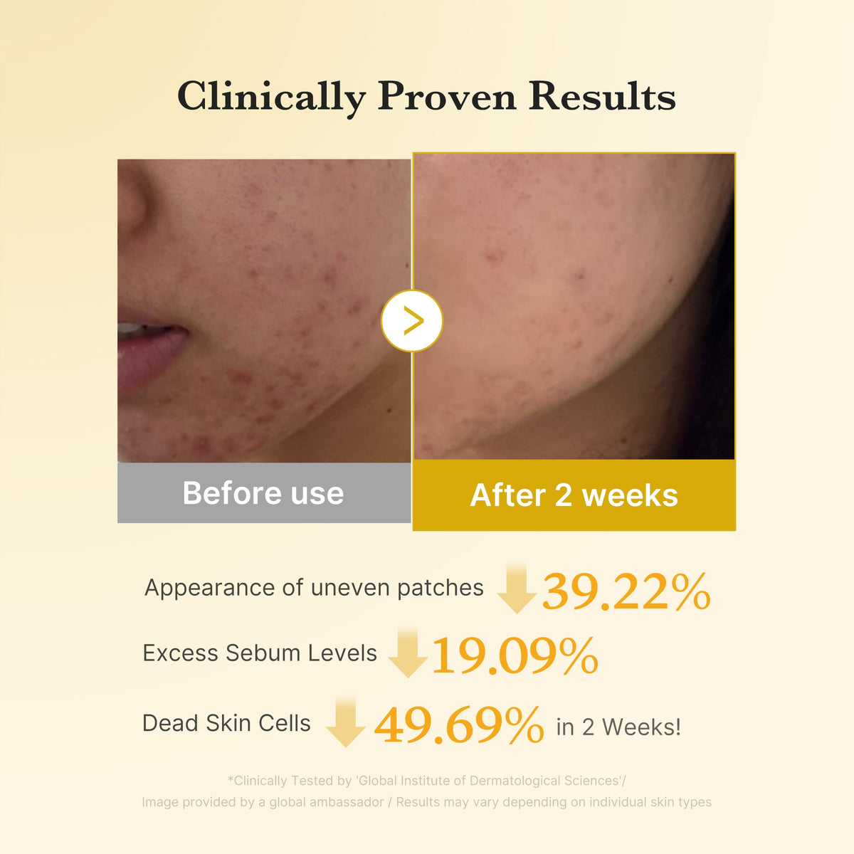 Kojic Acid Tumeric Toner Pad R0