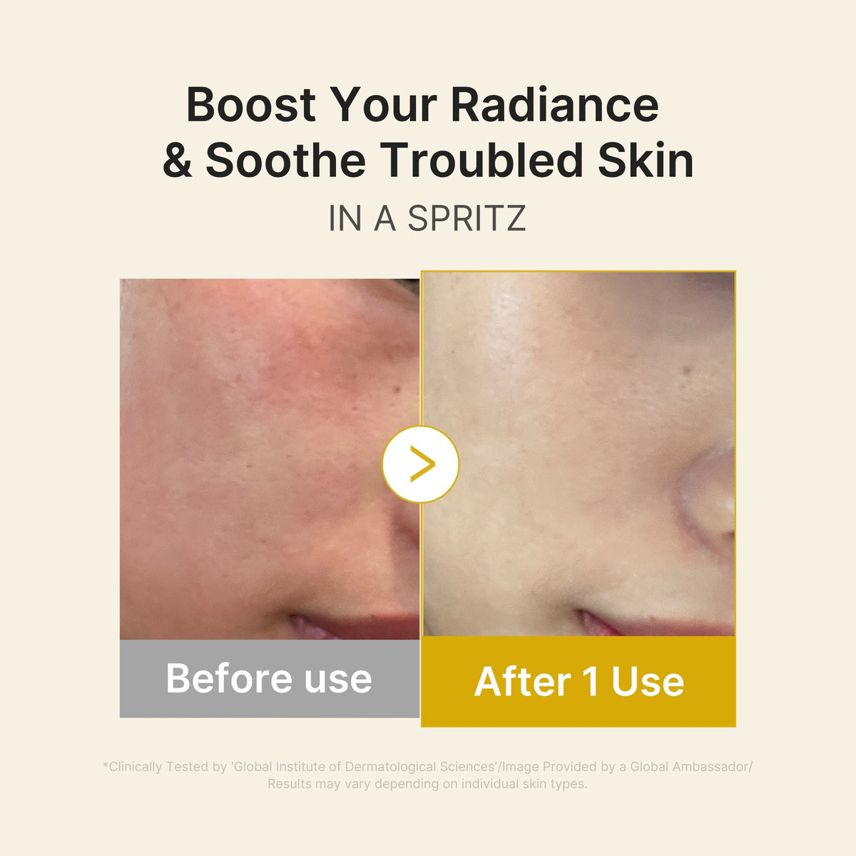Kojic Acid Turmeric Vitamin Gold Jelly Mist Serum E0