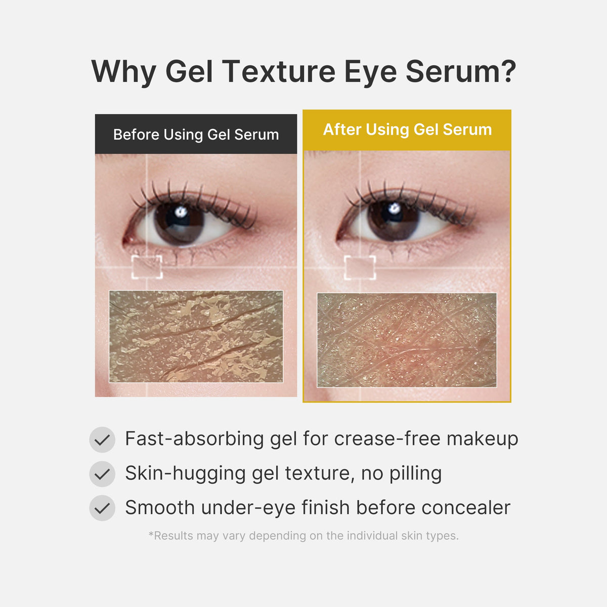 Kojic Acid Tumeric Eye Gel Serum S1