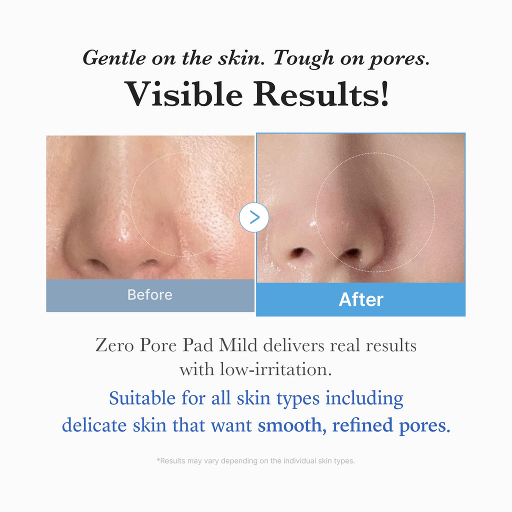 Zero Pore Madecassoside Pads (Mild) F7