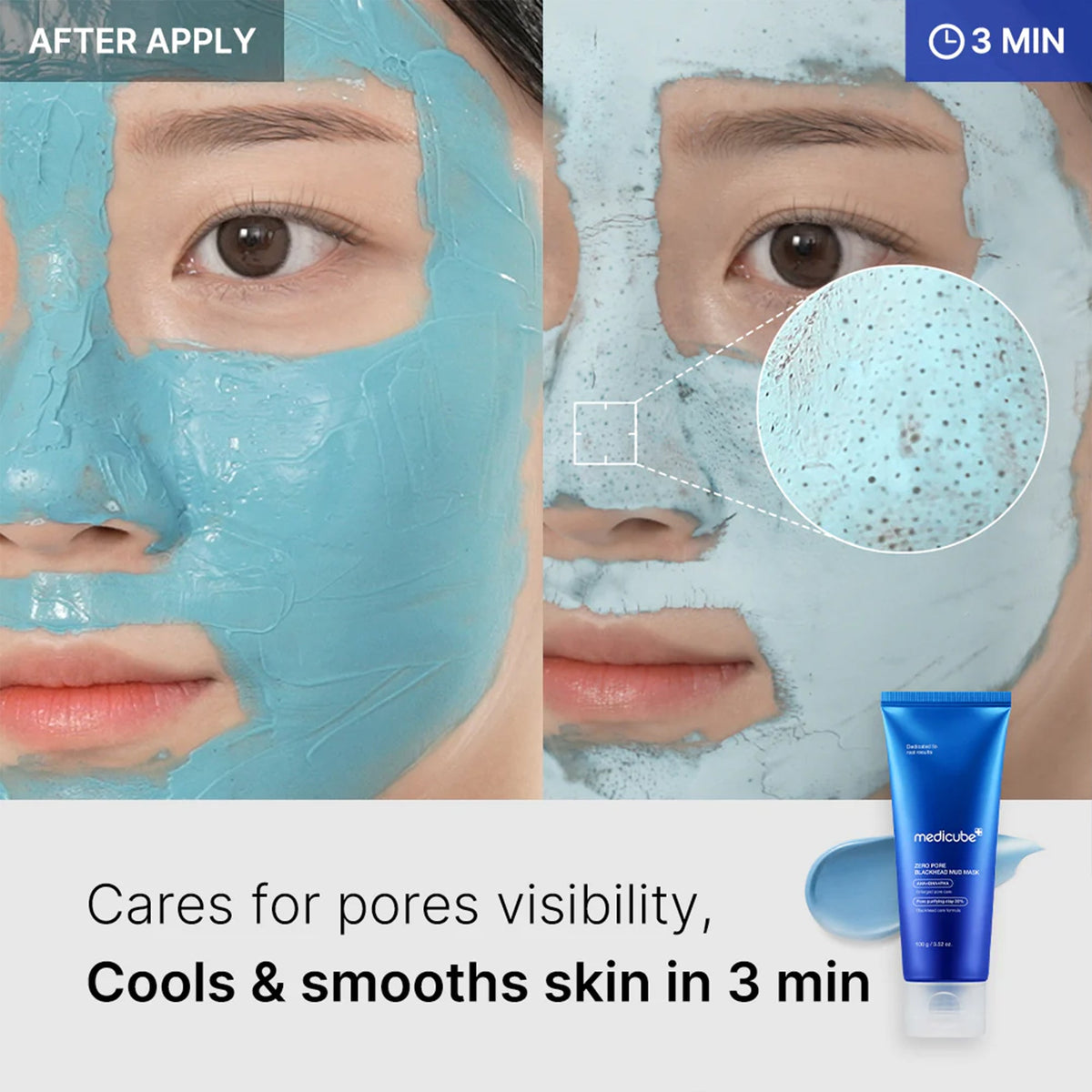 Zero Pore Blackhead Mud Mask S2
