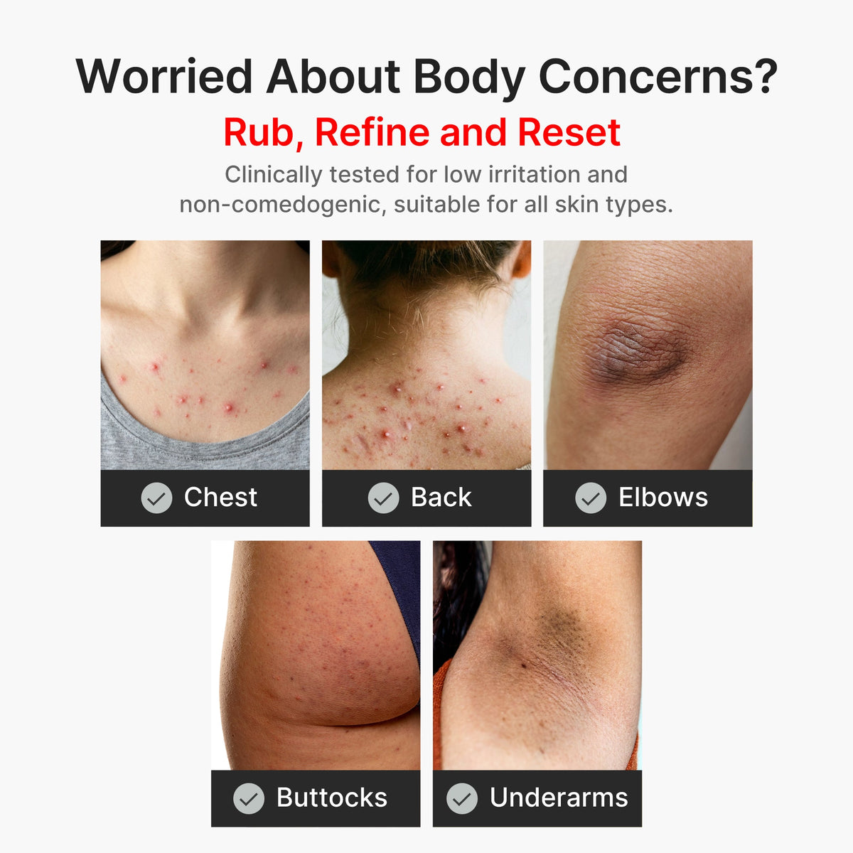 Kojic Acid Turmeric Body Peel Shot S3