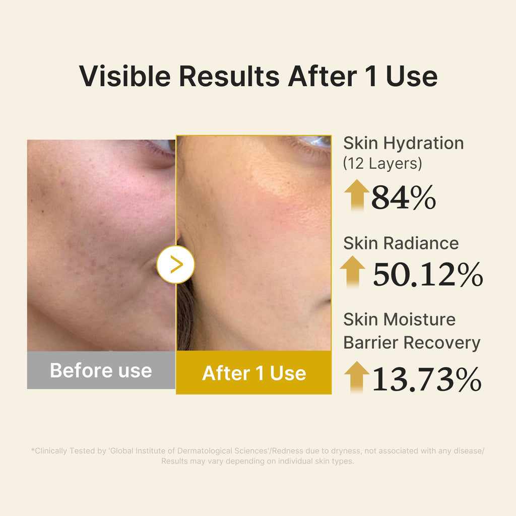 Kojic Acid Turmeric Vitamin Gold Jelly Mist Serum E0