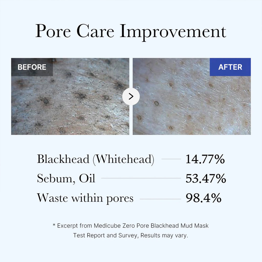 Zero Pore Blackhead Mud Mask S2