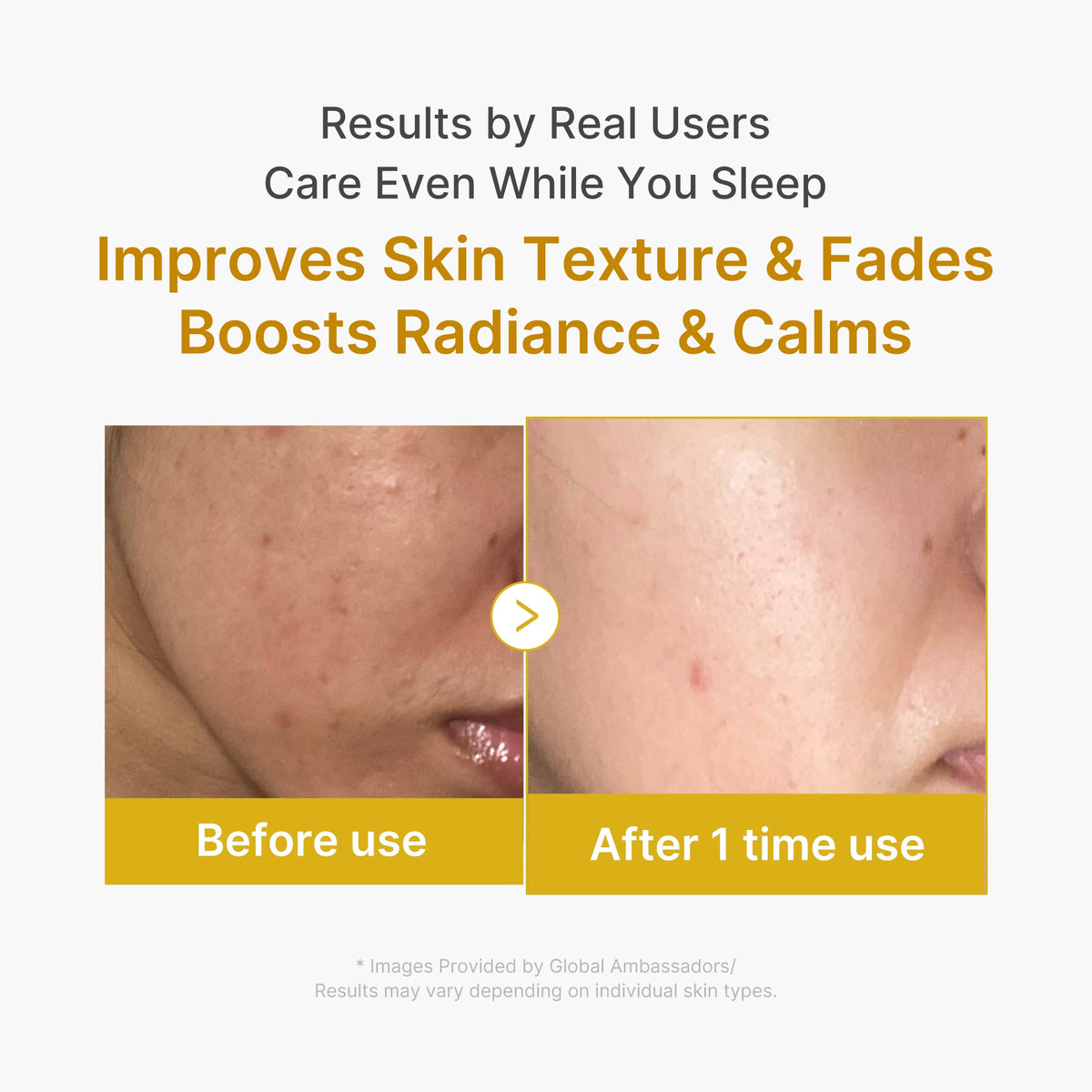 Kojic Acid Turmeric Overnight Wrapping Mask U8