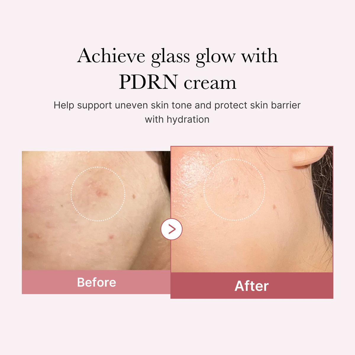 PDRN Pink Peptide Cream T9