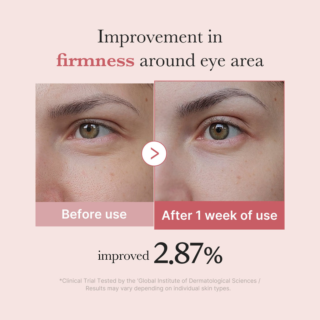 PDRN Pink Peptide Eye Cream Q1
