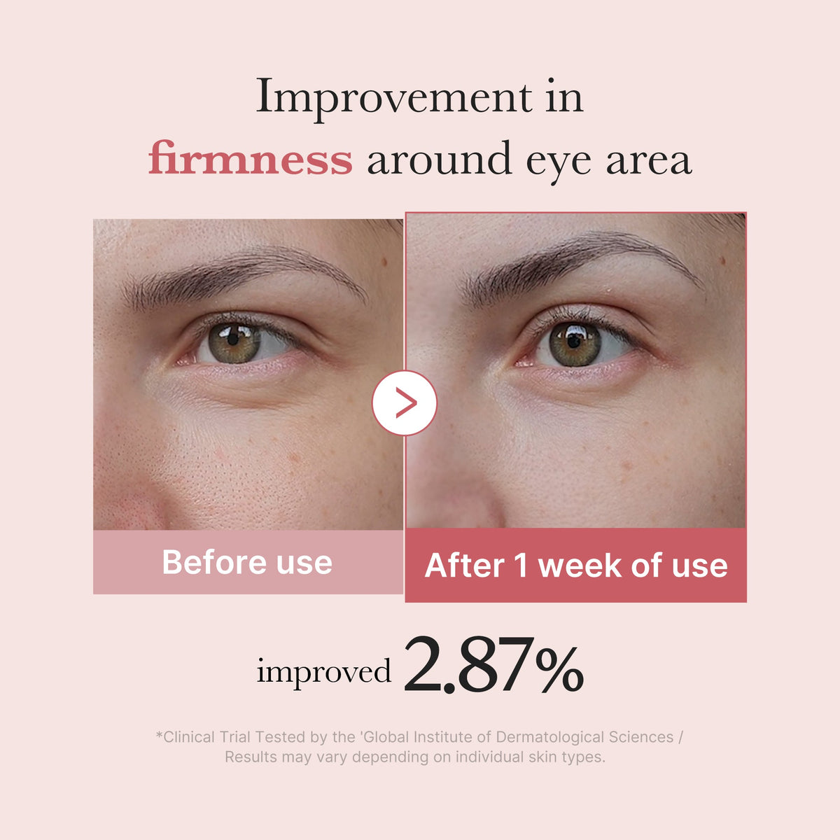 PDRN Pink Peptide Eye Cream Q1