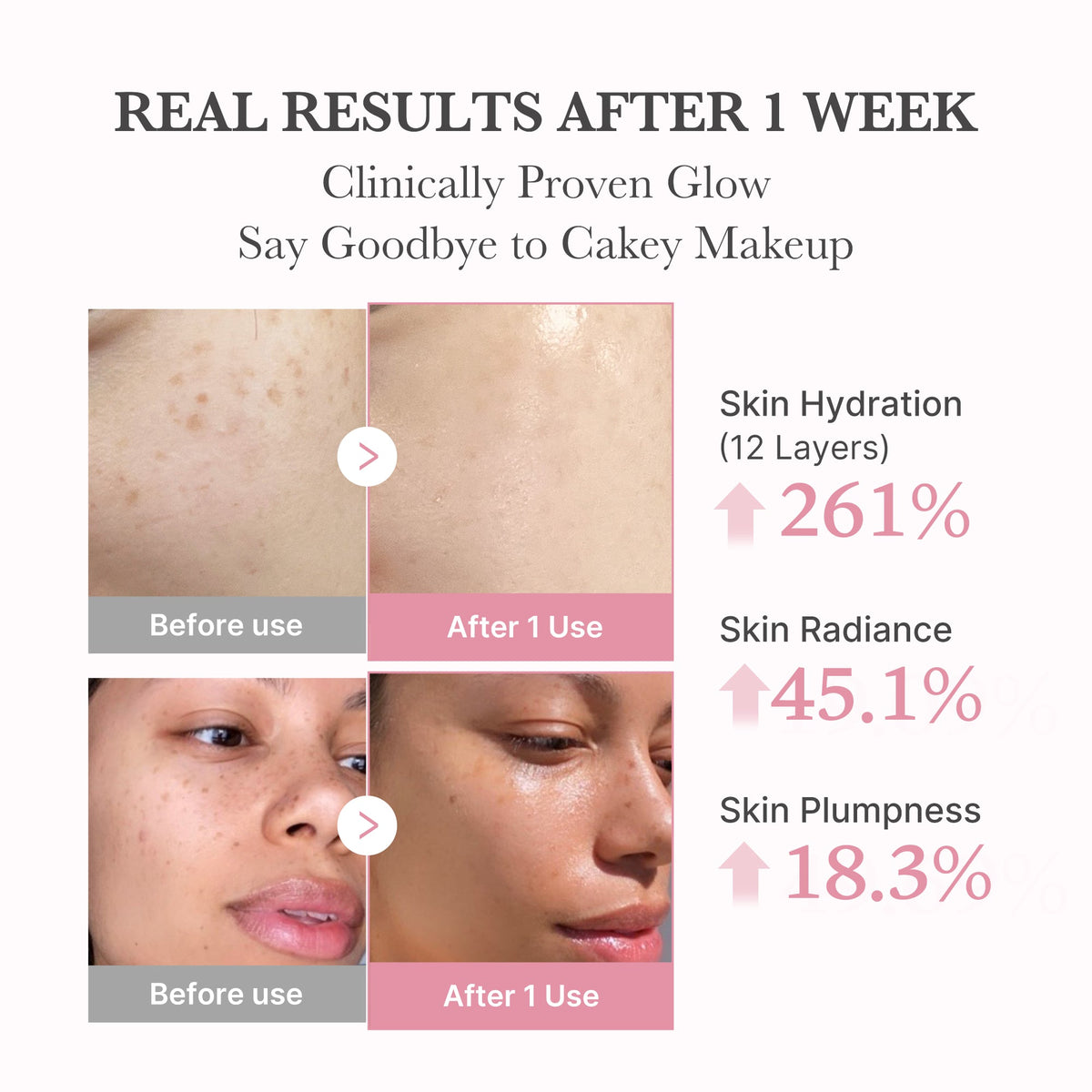 PDRN Pink Collagen Bubble Serum U8