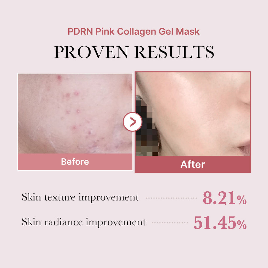 Salmon PDRN Pink Collagen Jelly Gel Mask H7