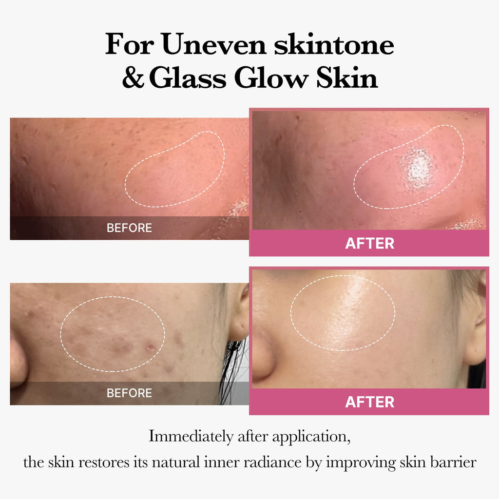 [Tati's Exclusive] Plump Perfection Set F7